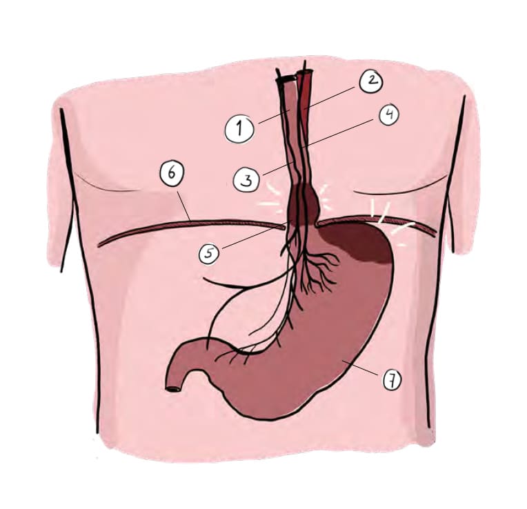 Reflux - viszerale Behandlung des Magens